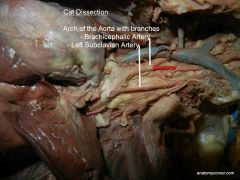Under Aortic Arch:


Brachiocephalic is on top of 
left subclavian