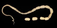 Flea Tapeworm(Genus Dipylidium)