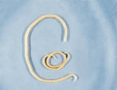 Roundworm Adult(Genus Toxocara)