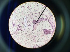 Identify the pink bacteria and its shape. Identify the purple bacteria and its shape. Which one is Gram Positive?