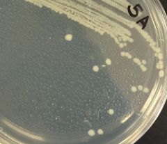 Compare colony growth of Escherichia coli and Staphylococcus epidermidis