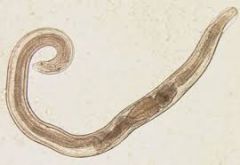 Pinworms Enterobius