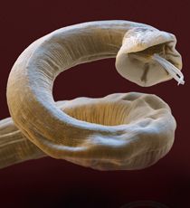 Lungworm (Family Metastrongylidae; Genus Metastrongylus, Dictyocaulus or Aelurostonglyus)