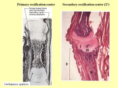 Endochondral (indirect ossification)