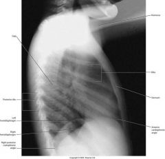pulmonary hilum
pulmonary vessels
costophrenic angles
RETROSTERNAL SPACE
RETROCARDIAC SPACE
hemidiaphrams
tracheal air shadow
thoracic spine
left ventricular border
LEFT ATRIAL BORDER
right ventricular border