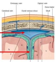 when two layers of dura mater meet and separate 2 hemispheres
midline, vertically oriented partitions 
brain: cerebri
cerebellum: cereblli