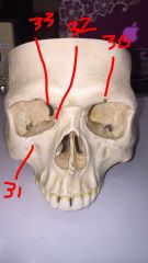30. Supraorbital foramina
31. Infraorbital foramina
32. Optic canal
33. Superior orbital fissure