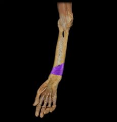 Action: pronates forearm


Origin: anterior surface of distal ulna


Insertion: anterior surface of distal radius


Innervation: median nerve