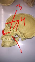 1. palantine
2. maxillary
3. ethmoid
4. paranasal sinuses
5. inferior nasal concha
6. superior and middle nasal concha
7. nasal cartilages
8. sphenoid
9. Pterygoid process of sphenoid bone