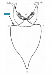 Posselt's from the frontal plane using incisor point:


IP to d is what kind of movement?