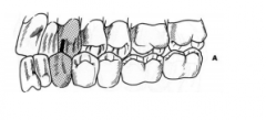 Posterior Teeth