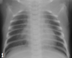Assess the technical aspect of the following radiograph. What is wrong with it ?