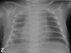 Assess the technical aspect of the following radiograph. What is wrong with it ?