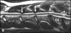 Rule out metabolic defects (esp. hypothyroidism), radiographs (may indicate malalignment or sliiping of vertebrae, narrowing of spinal canal, myelography, CT/MRI