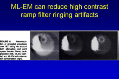 Ringing artifact: occurs when bright uptake in an organ results in decreased apparent signal in adjacent "less-hot" organ. Like shining or mach band
