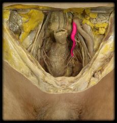 Identify the vascular structure highlighted in pink. What region of the body does it supply?