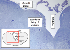 Choroid plexus produces the CSF