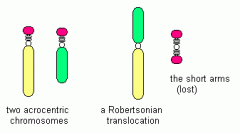 En translokation mellem de to korte arme af to acrocentriske kromosomer. De korte arme forsvinder, mens de to lange arme danner et kromosom. 


 


 