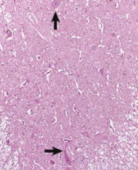 What neural tissue is this?