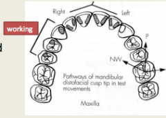 Which cusp (of what tooth) follows the P pathway shown in the diagram?