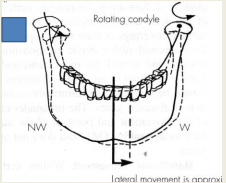 Left lateral mandibular motion is the result of rotation of the left working condyle around a vertical axis and translation of the right nonworking condyle downward, inward, and forward