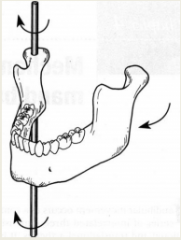 Right lateral mandibular motion is the result of rotation of the right working condyle around a vertical axis and translation of the left nonworking condyle downward, inward, and forward