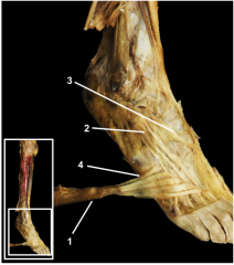 1.	Reflected extensor digitorum longus muscle
2.	Extensor digitorum brevis muscle
3.	Extensor hallucis brevis muscle
4.	Fibularis tertius muscle

(Note: The fibularis tertius muscle is a distinct muscle that branches off from the extensor dig...