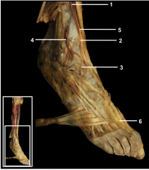 1.	Anterior tibial artery
2.	Dorsalis pedis artery
3.	Lateral tarsal artery
4.	Perforating branch artery
5.	Deep fibular nerve
6.	Cutaneous branch of the deep fibular nerve
(Note: The arteries were digitally enhanced to facilitate identifica...
