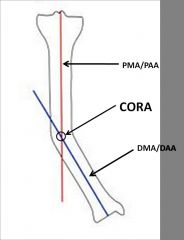 Which of the following is true regarding the center of rotation of angulation (CORA) as it refers to tibial diaphyseal angular deformity?  1-It is the point at which the prox mech axis and distal mech axis meet 
2-It is the point at which the pro...
