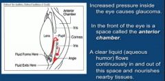 aqueous humor is made in the ciliary body, travels from posterior to anterior chamber and exits canal of schlem. When iris dilates, scrunches up like rolling up a shirt and blocks exit. Treatment is based on 1) stopping production of AqH w prostog...