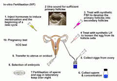 In Vitro fertilization (IVF)