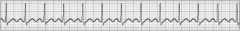 An elderly man is apneic and pulseless. The ECG shows the following rhythm, which you should interpret as: