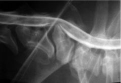 What does the x-ray show?

What is it an indication of?