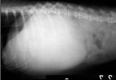 Abnormality shown by this abdominal x-ray?