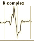 The K-complex:
Negative followed by positive deflection - neg. = up, pos. = down



Has to last .5-1 second


Must be 75 mV in amplitude