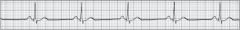 The MOST appropriate initial action for a 54-year-old man who presents with the following cardiac rhythm should consist of:  