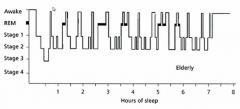 Wake up much more frequently

But REM still occurs (even modestly) every 90 mins approx.