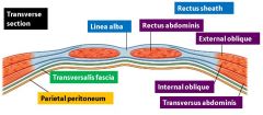Aponeuroses of internal oblique, external oblique and transversus abdominis