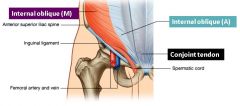 What forms the conjoint tendon in the inguinal canal?