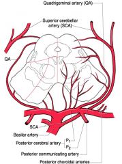 Midbrain Infarct: branches of PCA, 
   top of basilar arteries
