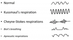 - Normal
- Kussmaul's respirations
- Cheyne-Stokes respirations
- Biot's breathing
- Apneustic respirations