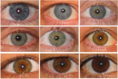 Alternative versions of a gene that produce obvious physical traits
a.	Ex. Eye color