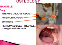 External oblique ridge and the pteryomandibular raphe