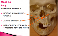 -incisive and canine fossae
-canine eminence
-infraorbital foramen (infraorbital nerves and vessels)