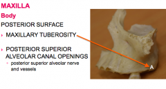 -maxillary tuberosity
-posterior superior alveolar canal openings