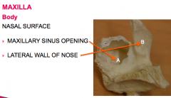 -maxillary sinus opening
-lateral wall of nose