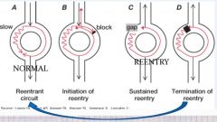 Reentry mechanism