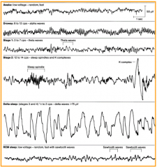 Stage 2 Sleep
- 12-14 Hz
- K complexes (tall peak)