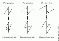 Created by the addition of two limbs, one at either end of the existing scar, similar to the length of the scar, and at 30*, 45* or 60* angles to it. 

Using 30* angles will elongate the scar by 25%
Using 45* angles will elongate the scar by 50...