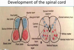 neuroblasts get added to the mantle layer on both sides of the neural tube giving a ventral and dorsal thickening


 


basal plate will contain ventral motor horn cells


 


alar plate will contain dorsal motor horn cells


 


su...